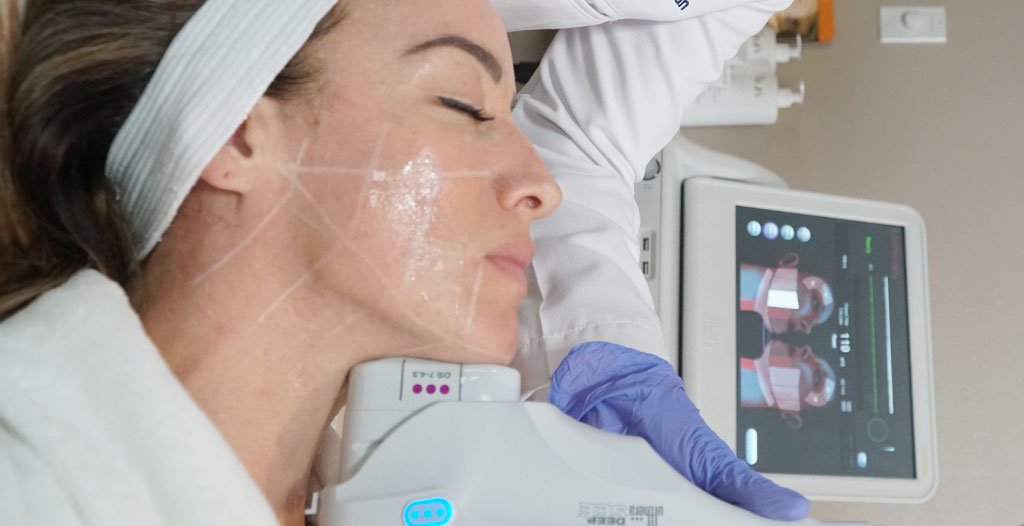 Ultherapy