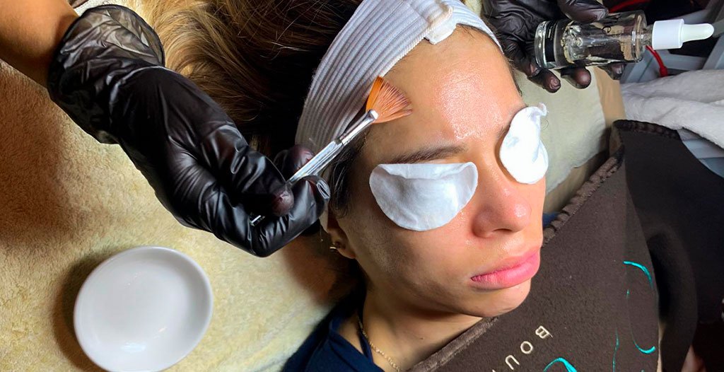 Medical Peels